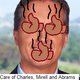 Illustration for article titled Did Charles J Harder Shit on the Floor in Open Court?